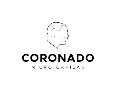 Micropigmentación Capilar Sevilla I Coronado Micro Capilar